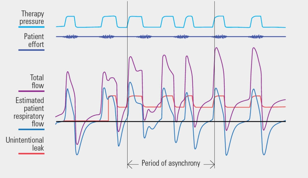 Vsync_diagram