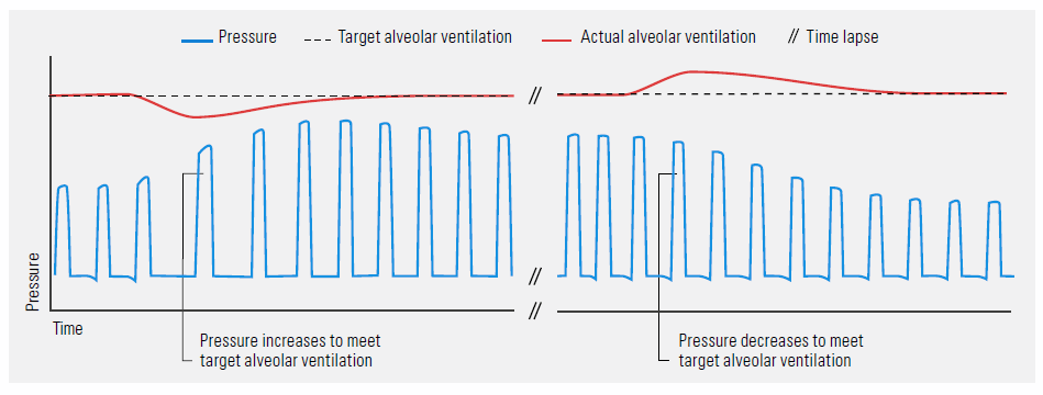 iVAPS_diagram